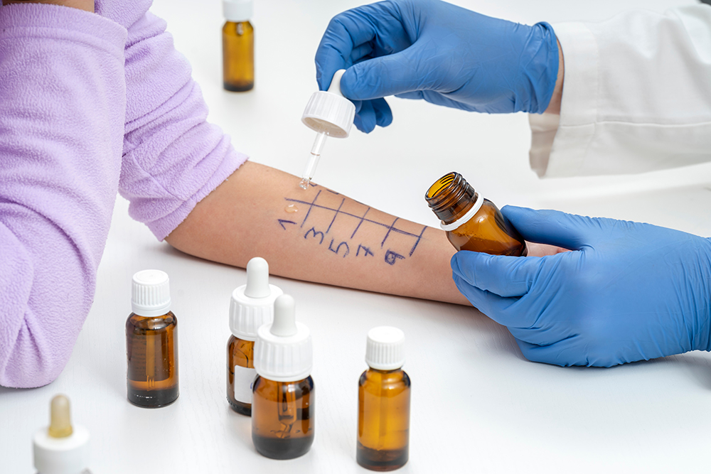 allergy test